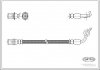Фото автозапчастини гальмівна трубка/шланг гнучкий передній R (довжина 290 мм, M10x1) TOYOTA HIACE IV 2.4/2.4D/2.7 08.87-11.01 CORTECO 19032953 (фото 1)
