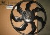Робоче колесо вентилятора (/) MOBIS 25231-2H000 (фото 2)