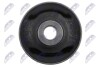 Фото автозапчасти arm bushing rubber-metal NTY ZTP-HD-051B (фото 3)