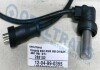 Фото автозапчастини czujnik EDC/FMR MB OM441/442 -96r ST Sensor Tech 1204990355 (фото 1)