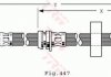 Гальмівная трубка/трос гнучка передня ліва/права (довжина 525мм, 10мм, M10x1, кожух) AUDI A2 1.2D-1.6 02.00-08.05 TRW PHD489 (фото 2)